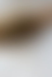 How much hair loss is normal? An inside scoop on your hair health..