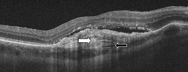 figure 14.jpg