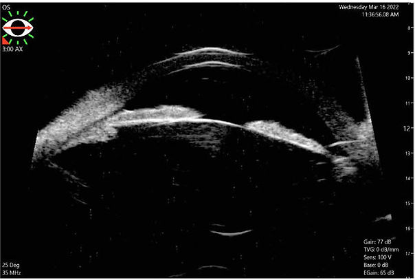 figure 2c.jpg