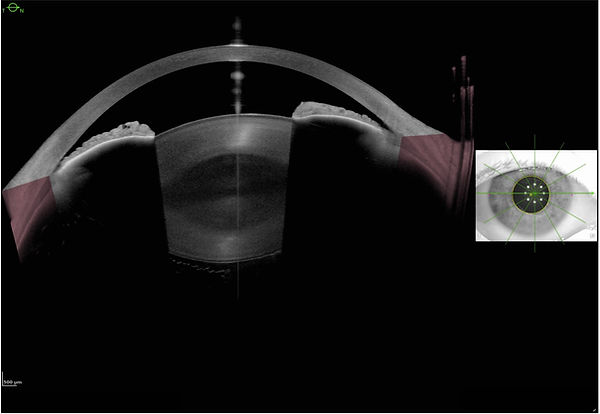 figure 1.jpg
