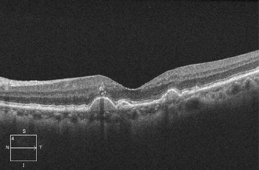 figure 8.jpg