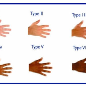 The "silent" red hair gene that kills more than redheads.