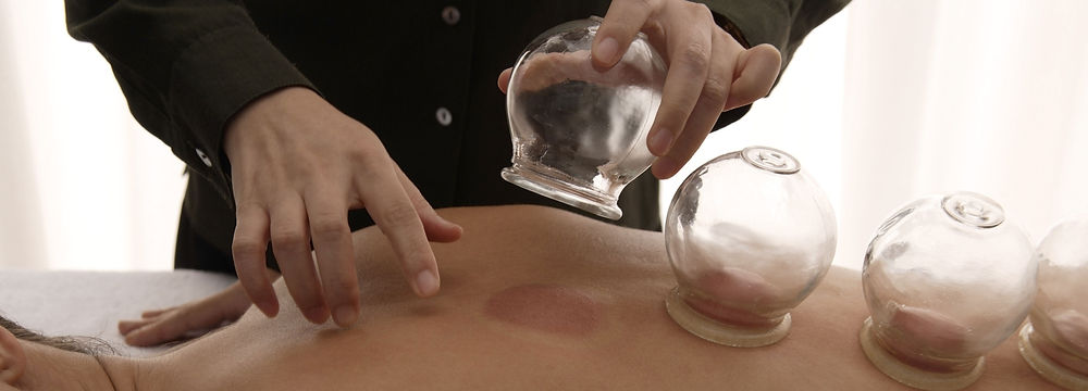 Cupping therapy in Paralimni, Cyprus