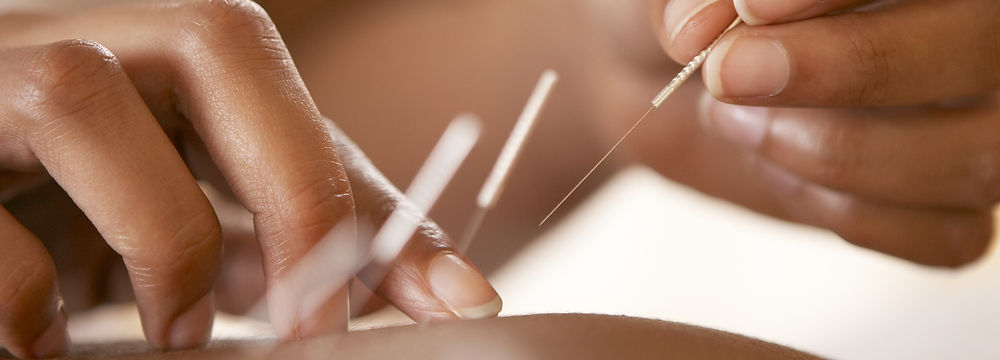 Acupuncture in Paralimni