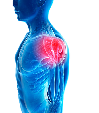 Shoulder Pain Relief By Agewell Corrective Exercise Specialists