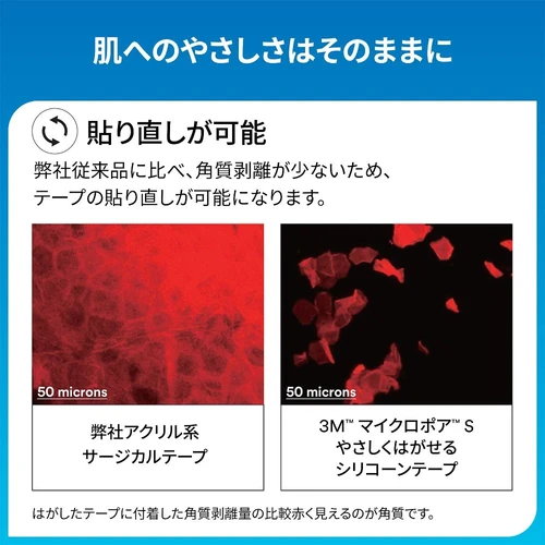 マイクロポア（TM）S やさしくはがせる シリコーンテープ 48袋入