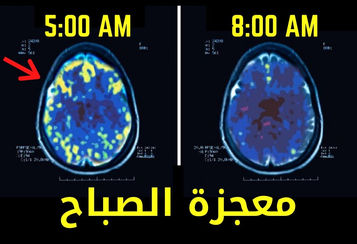 معجزة الصباح ..لن تصدق كيف يغيرالاستيقاظ فجرا حياتك