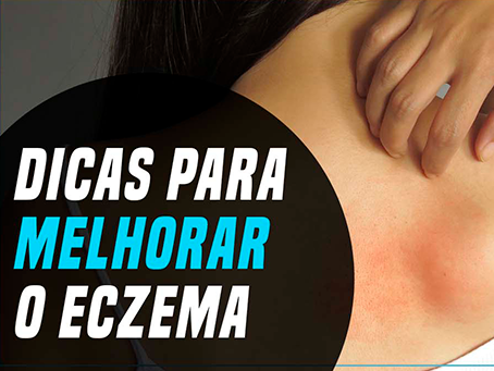 DICAS PARA MELHORAR O ECZEMA