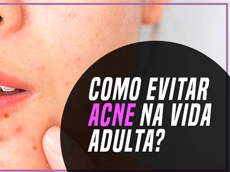 COMO EVITAR ACNE NA VIDA ADULTA?