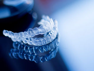 invisalign ou alinhadores invisíveis