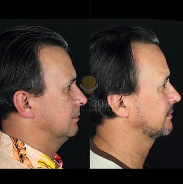 Antes e Depois de paciente