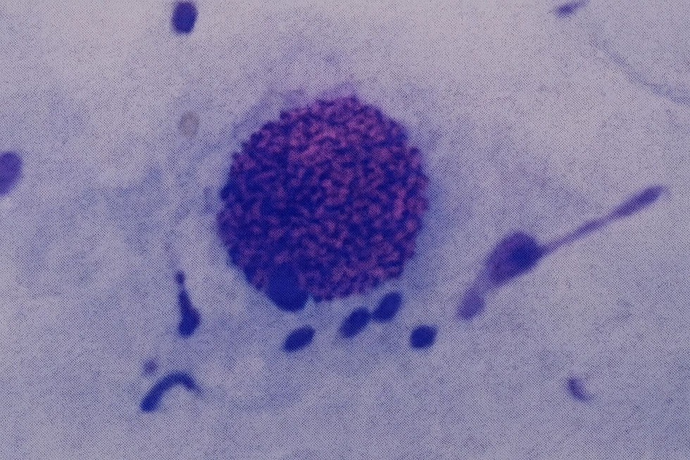 トキソプラズマ