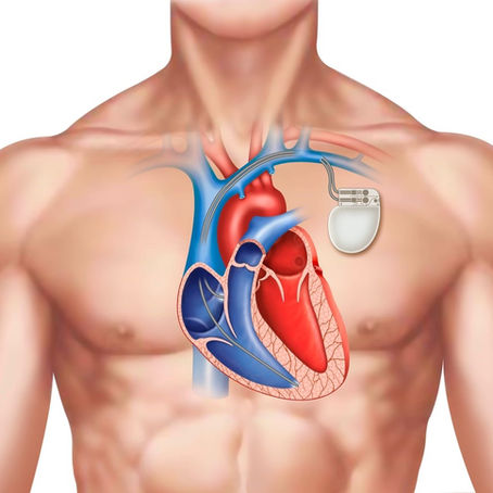 Medicinske meritve, Brda 18.02.2025
