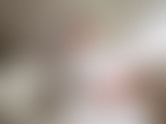 Surgery Recap - Pre-Op Day