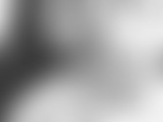 Heart Month - Day 9 (Surgery)