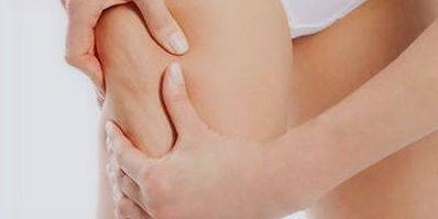 jambe-femme-cellulite_edited.jpg