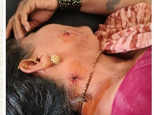 रुपूरमध्ये बिबट्याचा महिलेवर हल्ला !                                                        महिलेच्या प्रसंगावधानमुळे अनर्थ टळला; जखमी महिलेवर शिरुरच्या आरोग्य केंद्रात उपचार, प्रकृती स्थिर 