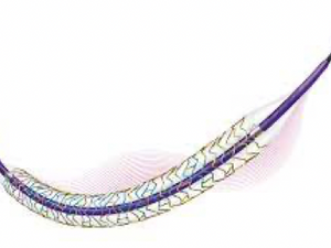 ANGIOPLASTIA CORONARIA COM IMPLANTE DE STENT