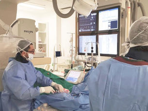 Denervação simpática renal para o tratamento da Hipertensão arterial de difícil controle