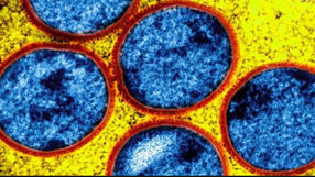 RDC : fin de l’épidémie de Mpox en tant qu’urgence nationale, mais la vigilance reste de mise