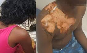 Touba : six mois de prison pour avoir ébouillanté son mari par jalousie