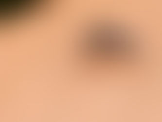 Van 699 casos de dengue en Coahuila