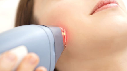 Laser Hair Removal