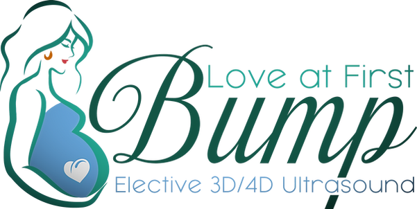 Love at First Bump_edited.png