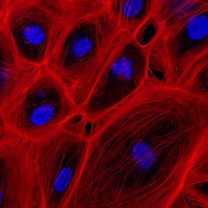 Phalloidin and DAPI stained human embryonic stem cells grown in 2D