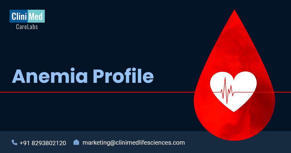Are you Sure you have Iron Deficiency? Anemia Profile Test Clinimed