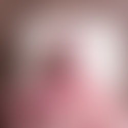 Fotografia newborn de bebê com síndrome de down em pose orgânica sobre uma mini cama enrroladinho, destacando a delicadeza e segurança no estúdio Mel Basso em São Caetano.