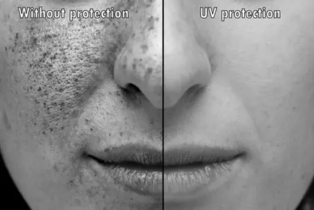 The Truth About Sunscreen and Sun Damage: What You Need to Know