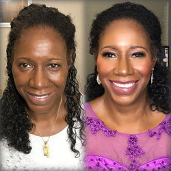 Mother of the Bride Enhancement