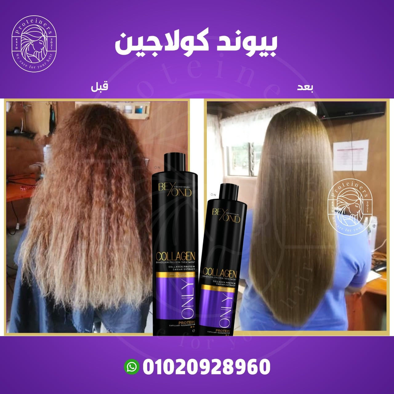 Beyond collagen - بيوند كولاجين