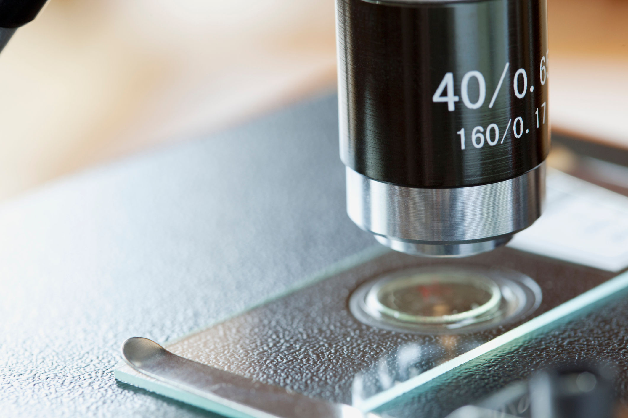 Examen de aspirados o impresiones