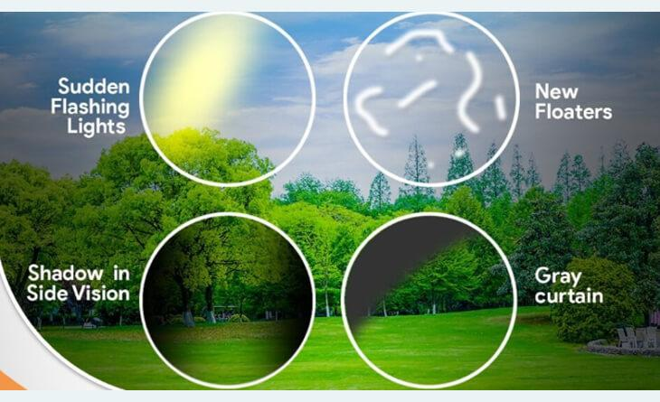 Simulação de moscas volantes e flashes luminosos associados ao descolamento de retina.