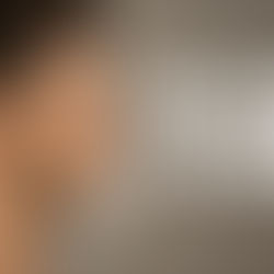 Jawline Wien Guide 2026: Ihr Weg zur Perfekten Kieferlinie