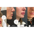 Schönheitstrend in Wien: Lippenaufspritzen mit Hyaluronsäure – Marken, Kosten und Ergebnisse