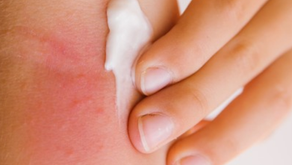 O hábito de passar uma pomada nas lesões de pele, sem orientação médica