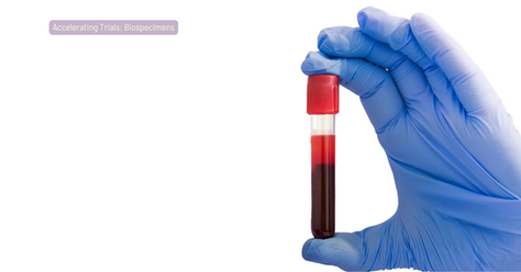 A blood collection tube held by a gloved hand