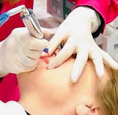 Pigmentierung Lippen