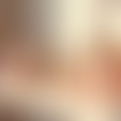 痛くないバレないシミケア