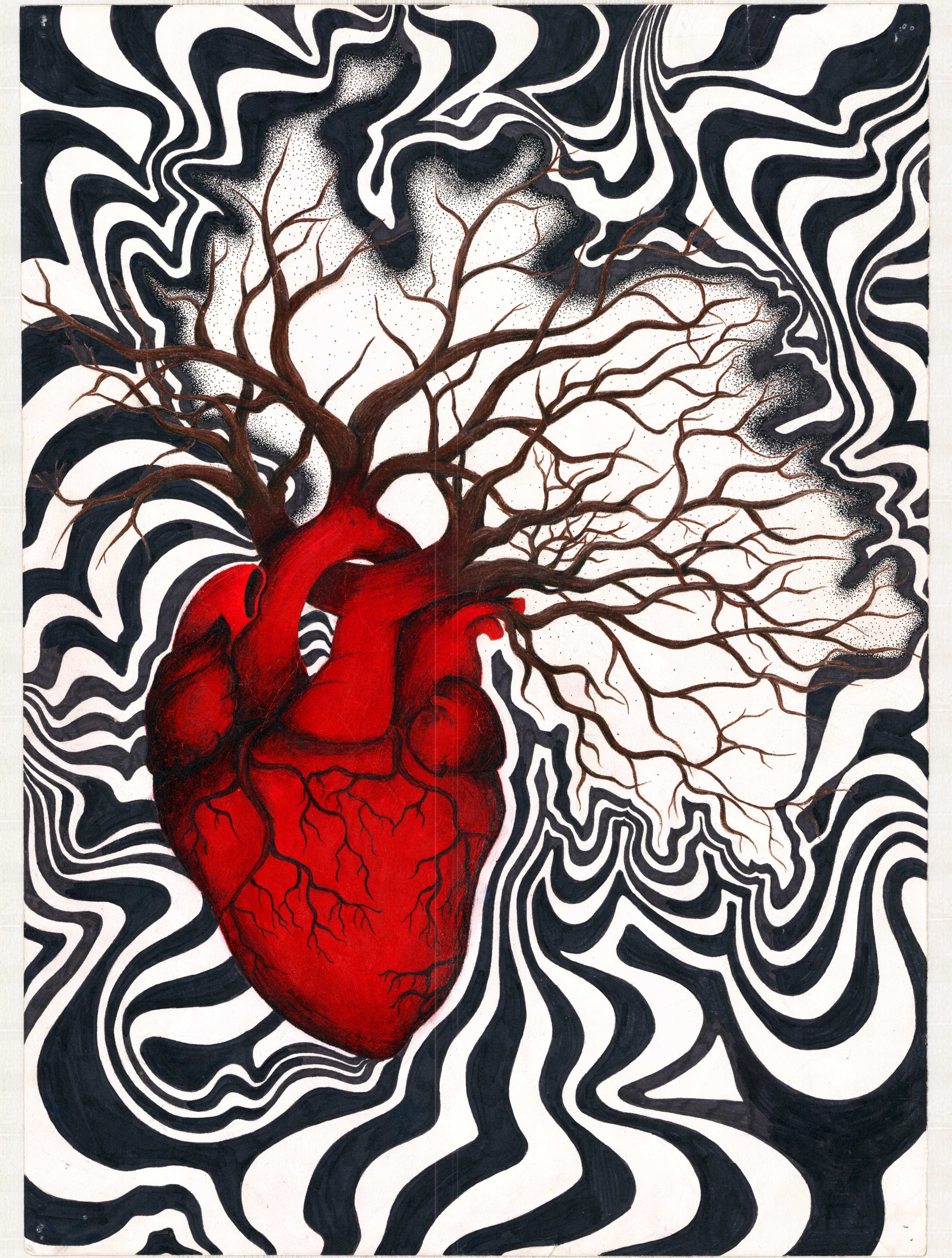 Anatomical Tree Heart