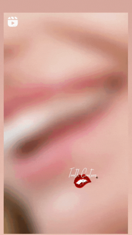 TC Tooth Gems (1).gif