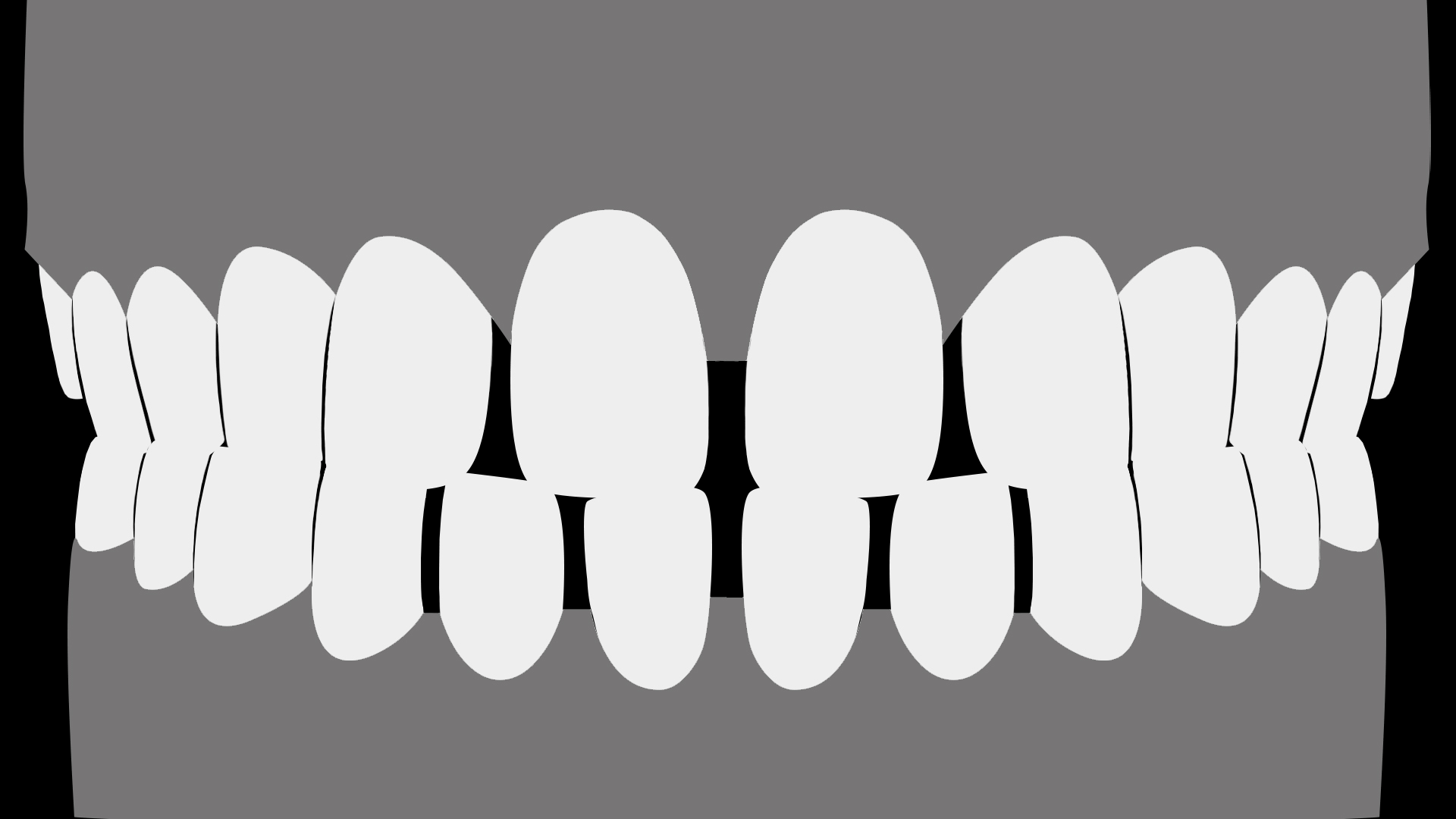 Spacing-case Mid.gif