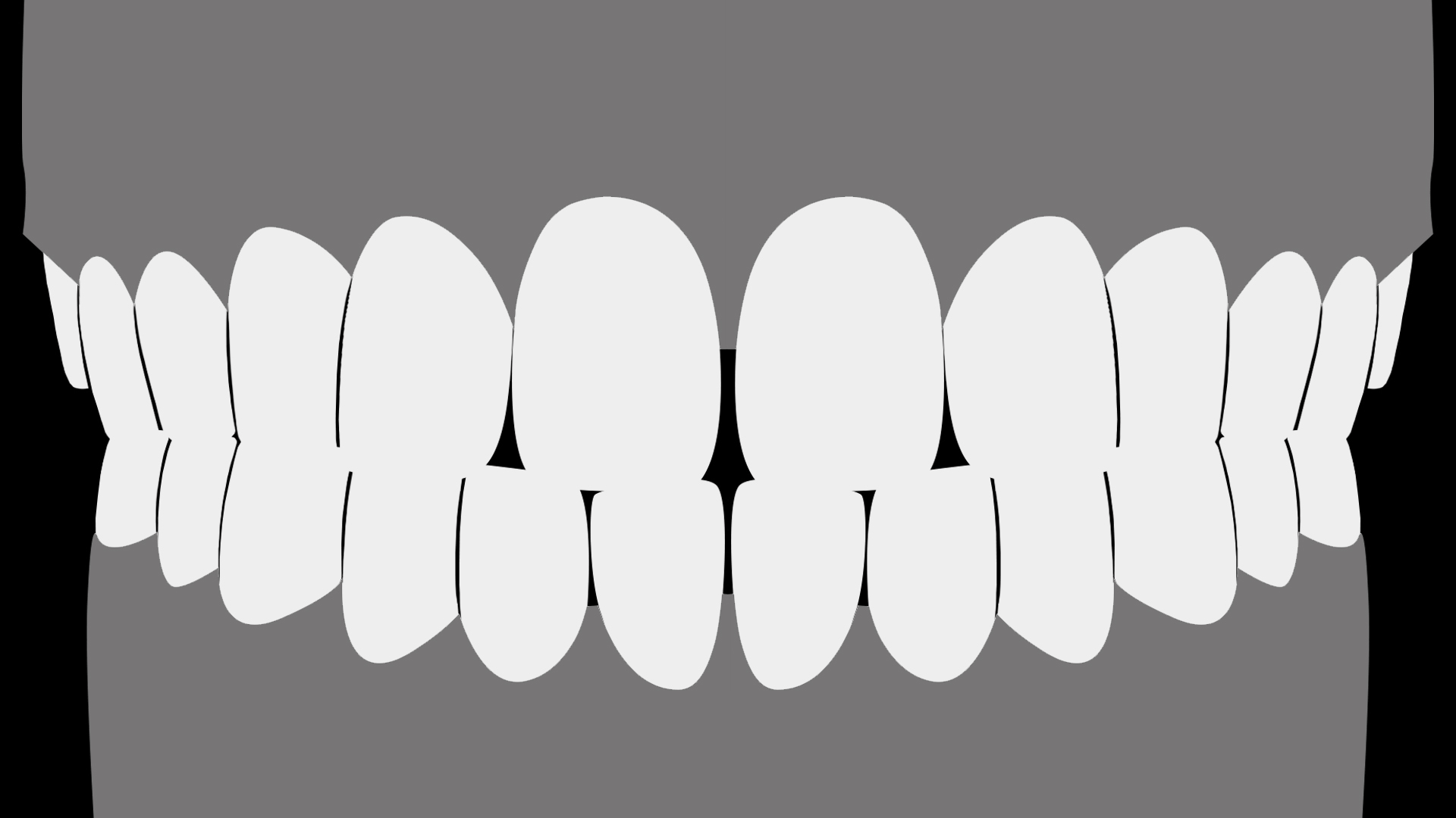 Spacing-case Short.gif