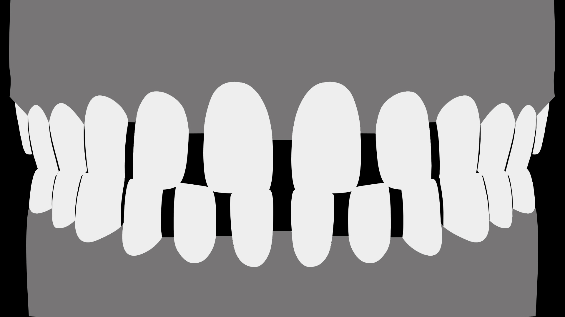 Spacing-case Long.gif