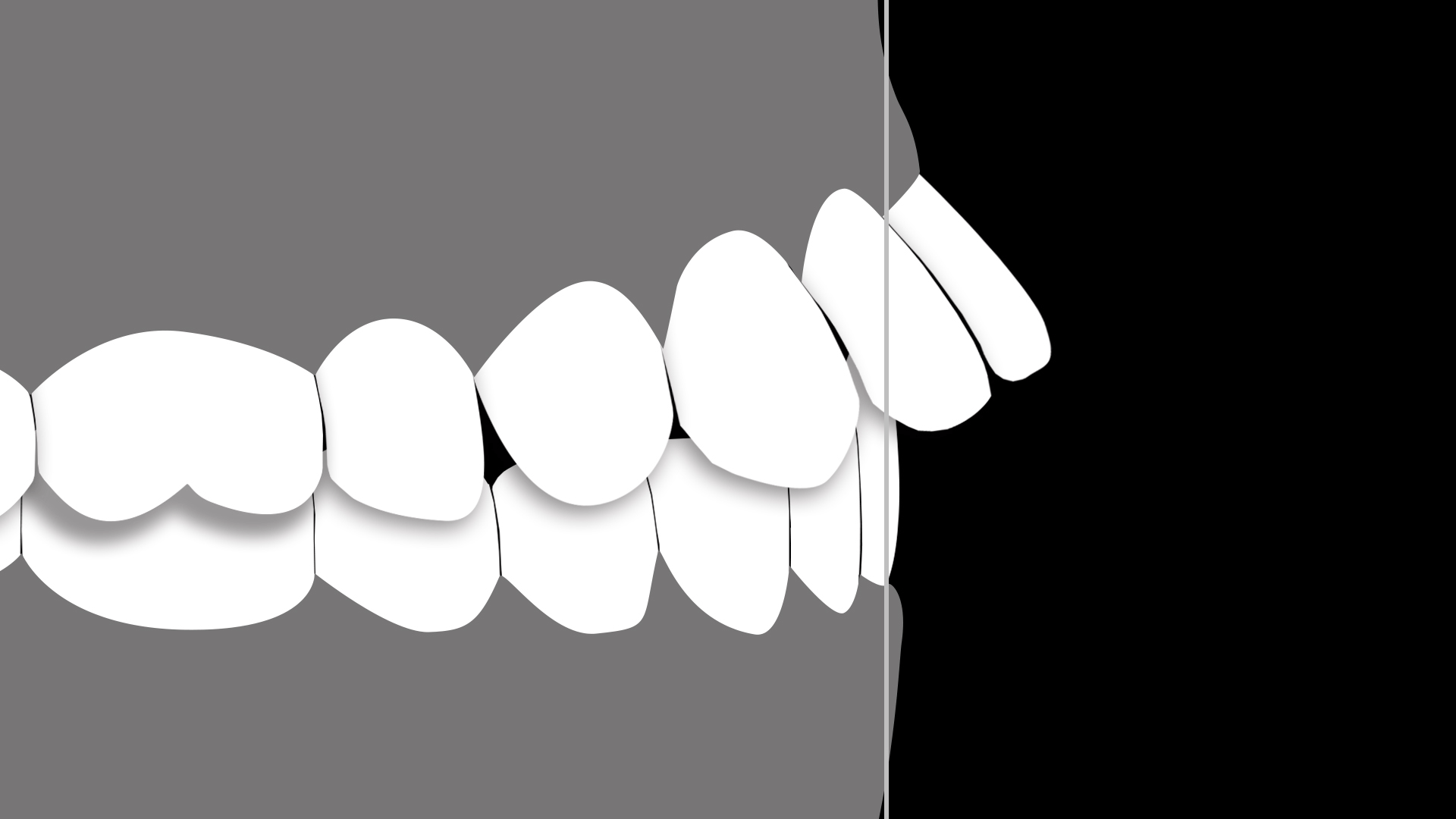 Protrusion Long.gif