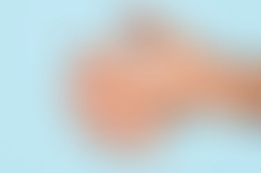 ¿SUDOR EXCESIVO SIN RAZÓN APARENTE? PODRÍAS TENER HIPERHIDROSIS