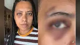 Influenciadora leva seis pontos após agressão em roda de samba no Rio
